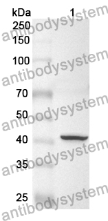 Anti-ACVR1 Polyclonal Antibody