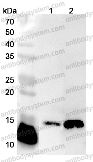 Anti-Human SSBP1 Polyclonal Antibody