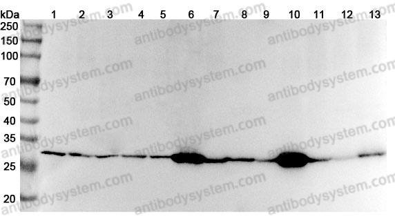 Anti-Human YWHAH Polyclonal Antibody