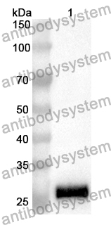 Anti-Human SRY Polyclonal Antibody