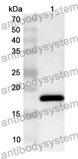 Anti-CLC Polyclonal Antibody