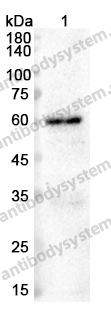 Anti-GAD2/GAD65 Polyclonal Antibody