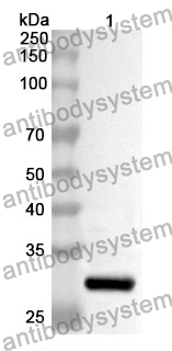 Anti-PTK2 Polyclonal Antibody