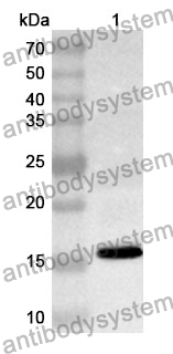 Anti-LIPE Polyclonal Antibody