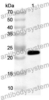 Anti-PRKCZ Polyclonal Antibody