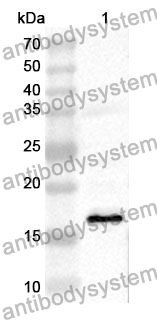 Anti-Human CALD1 Polyclonal Antibody