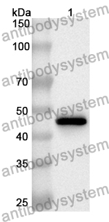 Anti-COL14A1 Polyclonal Antibody