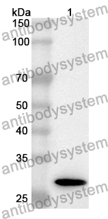 Anti-Human RNASEL Polyclonal Antibody