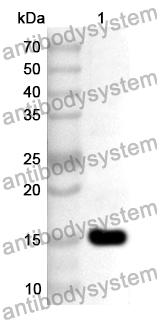 Anti-CHRNB3 Polyclonal Antibody