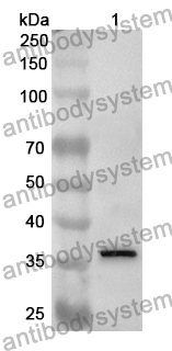 Anti-Human SLC18A2 Polyclonal Antibody