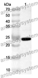 Anti-ITIH3 Polyclonal Antibody