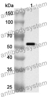 Anti-Human PPAT Polyclonal Antibody