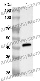 Anti-Human GFPT1 Polyclonal Antibody