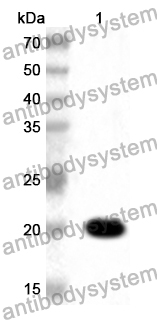 Anti-Human AOX1 Polyclonal Antibody