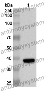 Anti-Human RBPJ Polyclonal Antibody