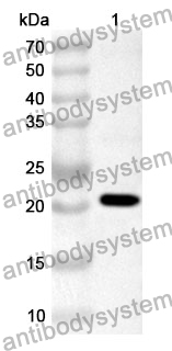 Anti-TYRO3/DTK/SYK Polyclonal Antibody