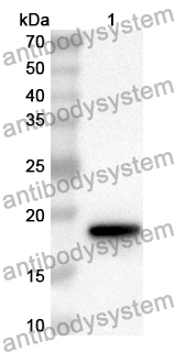 Anti-GABPA Polyclonal Antibody