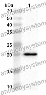 Anti-Human GABPB1 Polyclonal Antibody