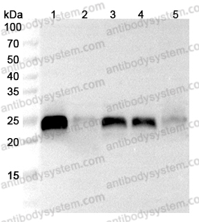 Anti-Human PRDX1 Polyclonal Antibody