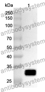 Anti-CD249/ENPEP Polyclonal Antibody