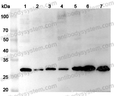 Anti-Human DPT Polyclonal Antibody