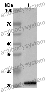 Anti-Human KHDRBS1 Polyclonal Antibody