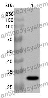 Anti-KLC1 Polyclonal Antibody