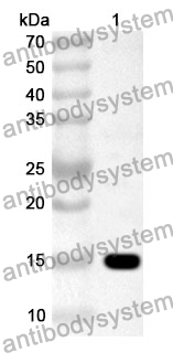 Anti-PPARA Polyclonal Antibody