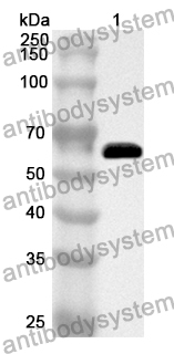 Anti-Human SOS1 Polyclonal Antibody