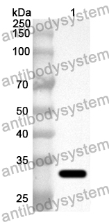 Anti-TNK2 Polyclonal Antibody