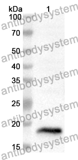 Anti-Human FOXM1 Polyclonal Antibody