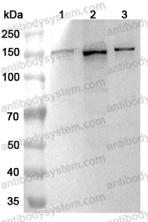 Anti-Human DHX9 Polyclonal Antibody