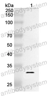 Anti-CD167a/DDR1 Polyclonal Antibody