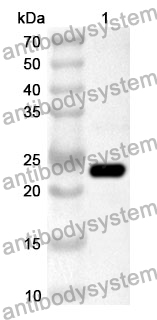 Anti-LGALS3BP Polyclonal Antibody