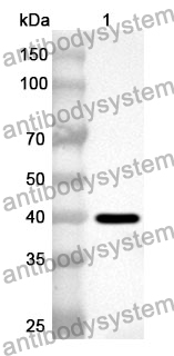 Anti-Human PDE4D Polyclonal Antibody