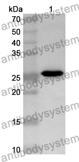 Anti-DSC1 Polyclonal Antibody