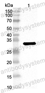 Anti-Human ADCY1 Polyclonal Antibody