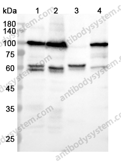 Anti-NSUN2 Polyclonal Antibody