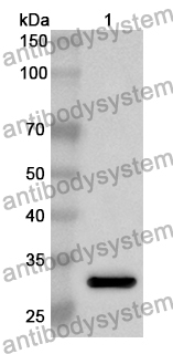 Anti-Human NCBP1 Polyclonal Antibody