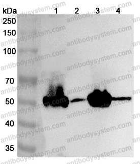 Anti-Human LMOD3 Polyclonal Antibody