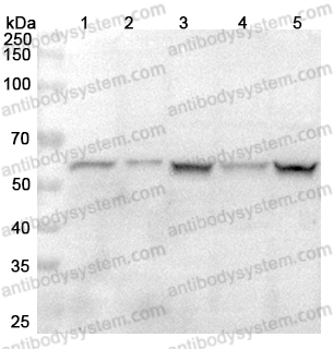 Anti-HSPA14 Polyclonal Antibody