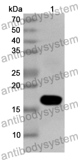 Anti-Human DBP Polyclonal Antibody