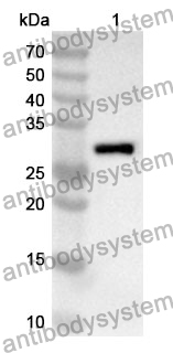 Anti-TWF1 Polyclonal Antibody