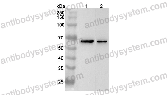 Anti-Human KCNH2/ERG1 Polyclonal Antibody