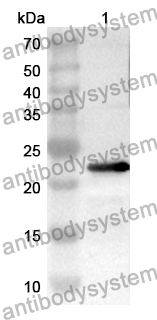 Anti-Human POU4F2 Polyclonal Antibody