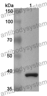 Anti-KIF5A Polyclonal Antibody