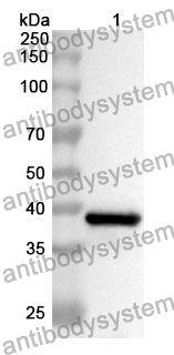 Anti-CDH17 Polyclonal Antibody