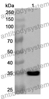 Anti-MERTK Polyclonal Antibody