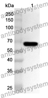 Anti-GRIN2A Polyclonal Antibody