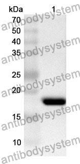 Anti-GRIN2A Polyclonal Antibody